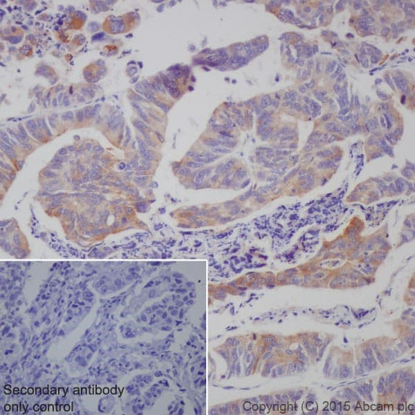 Granulin Antibody Epr15864 Low Endotoxin Azide Free Ab225532  Immunohistochemistry Formalin Pfa Fixed Paraffin Embedded Sections Img134021