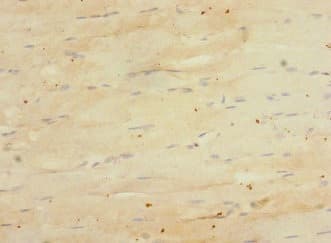 Anti-Endomucin antibody(AB230018)