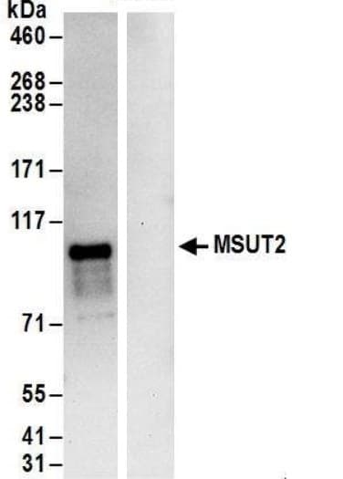 Zc3h14 Antibody Ab169061  Immunoprecipitation Img117095