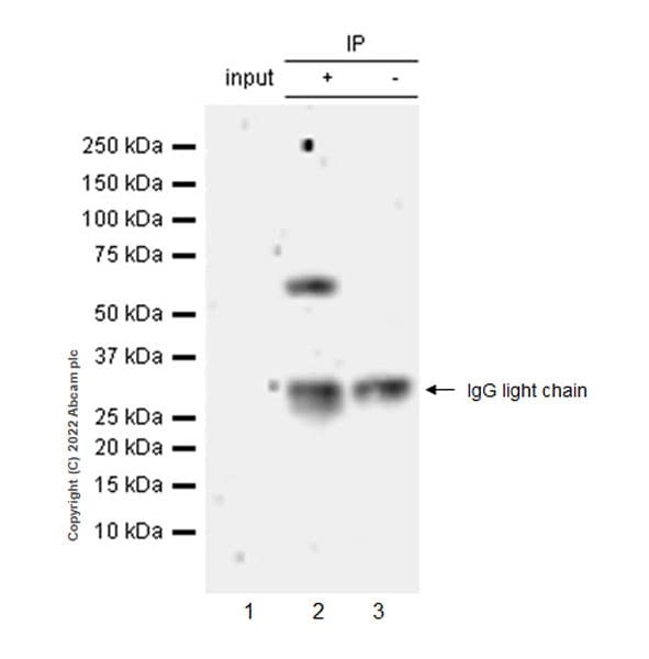Anti-MAdCAM1 antibody [EPR27223-77](AB307827)