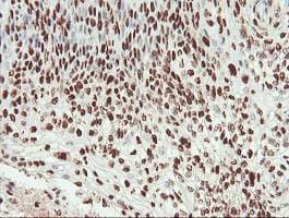 Samhd1 Antibody Oti1a1 Ab128107  Immunohistochemistry Formalin Pfa Fixed Paraffin Embedded Sections Img69273