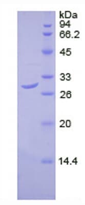 Recombinant Human Pyruvate Dehydrogenase E2 protein (His tag)(ab275559)
