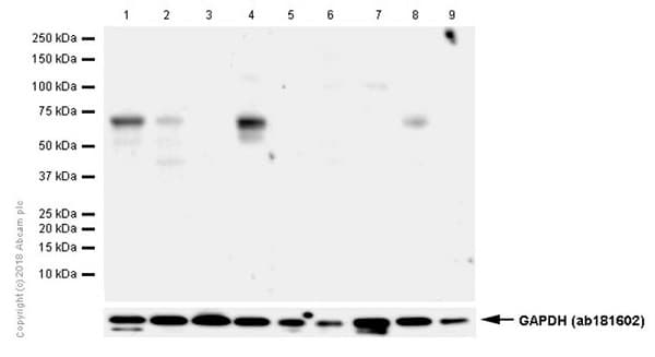 Anti-Estrogen Receptor alpha antibody [E115] - ChIP Grade(ab32063)