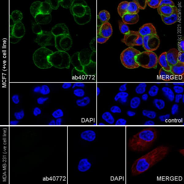 Anti-E Cadherin antibody [EP700Y] - Intercellular Junction Marker(AB40772)