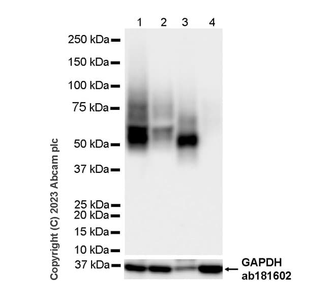Anti-LYVE1 antibody [RM1067](AB314241)