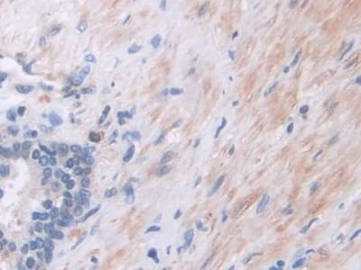 Anti-PI3 Kinase p110 beta antibody(ab232997)