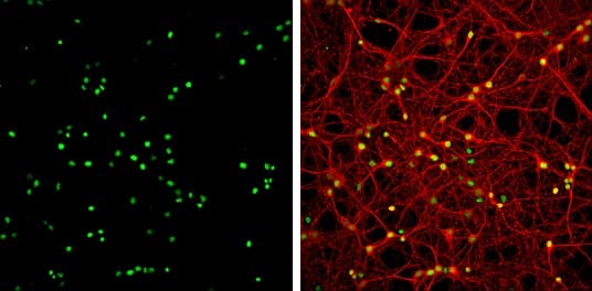 Hmgb1 Antibody N Terminal Ab228624  Immunocytochemistry Immunofluorescence Img68705