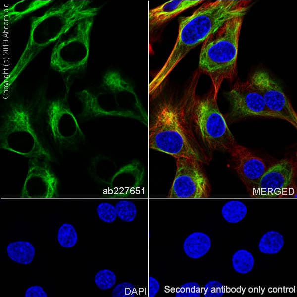 Anti-Desmin antibody [SP138] - C-terminal(AB227651)