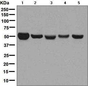 Anti-Monoamine Oxidase B/MAOB antibody [EPR7102] - BSA and Azide free(AB248436)