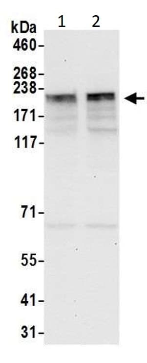 Anti-KIF14 antibody(AB3747)