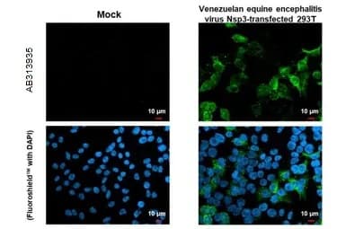 Anti-Venezuelan equine encephalitis virus nsp3 antibody [HL1502] - BSA and Azide free(ab313935)