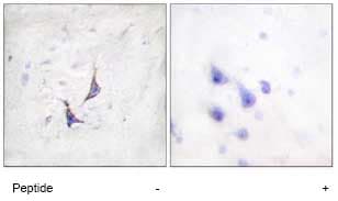 Anti-Syndecan 4 antibody(AB74139)