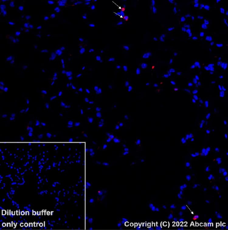Alexa Fluor® 647 Anti-Ly6g antibody [EPR22909-135](AB303467)