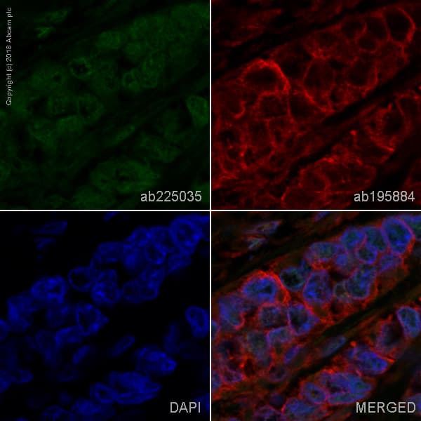 Alexa Fluor® 488 Anti-RPA32/RPA2 antibody [EPR2877Y](AB225035)