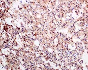 Scgn Secretagogin Antibody Epr7477 Bsa And Azide Free Ab248768  Immunohistochemistry Formalin Pfa Fixed Paraffin Embedded Sections Img104416