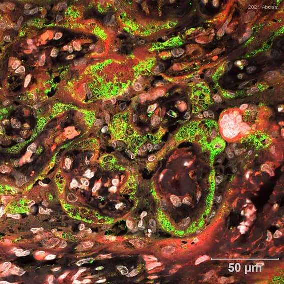 Anti-C5b-9 antibody(AB55811)