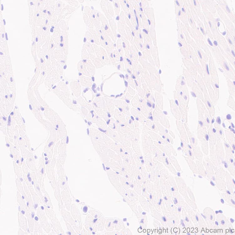 Anti-MATH2/NEUROD6 antibody [EPR28660-23](AB315812)