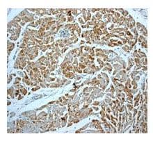 Creatine Kinase B Type Antibody Epr3926 Ab108388  Immunohistochemistry Formalin Pfa Fixed Paraffin Embedded Sections Img24169