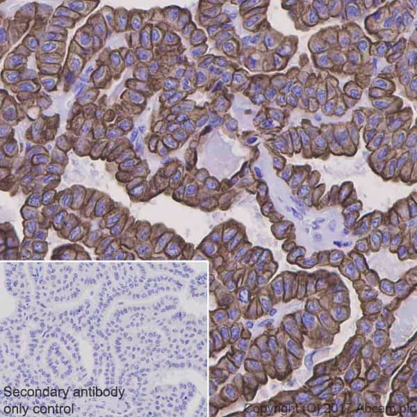 Anti-Cytokeratin 8 antibody [EP1628Y] - Cytoskeleton Marker(AB53280)