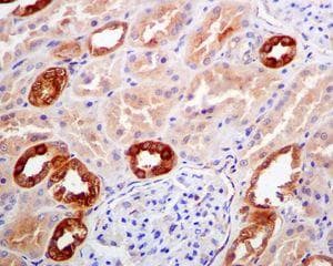 Anti-Retinoic Acid Receptor beta antibody [EPR2017](AB124701)