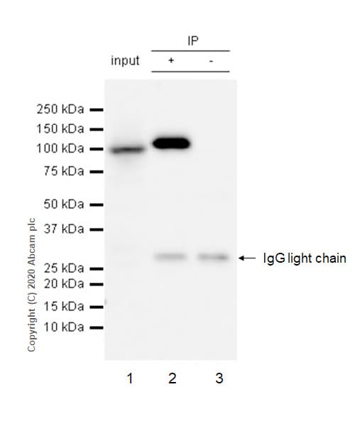 Alpha Actinin Actn1 Antibody Ep2527y Bsa And Azide Free Ab239858  Immunoprecipitation Img11208