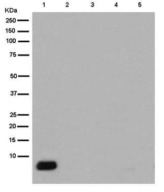 Anti-beta Amyloid 1-42 antibody [EPR9296](AB180956)