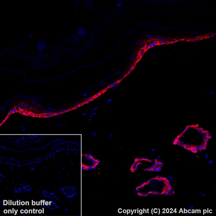 Alexa Fluor 647 Cytokeratin 5 Antibody Ep1601y Ab193895  Immunohistochemistry Formalin Pfa Fixed Paraffin Embedded Sections Img448923