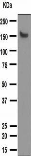 Mybpc3 Antibody Epr30082 Ab108522  Western Blot Img95643