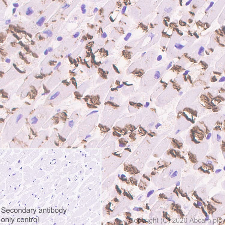 Anti-pan Cadherin antibody [EPR1792Y] - Intercellular Junction Marker(AB51034)