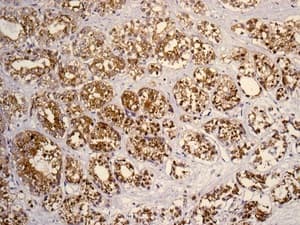 Slc45a3 Antibody Epr47952 Bsa And Azide Free Ab242056  Immunohistochemistry Formalin Pfa Fixed Paraffin Embedded Sections Img91386