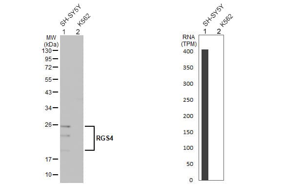 Rgs4 Antibody Hl1522 Ab308160  Western Blot Img441315