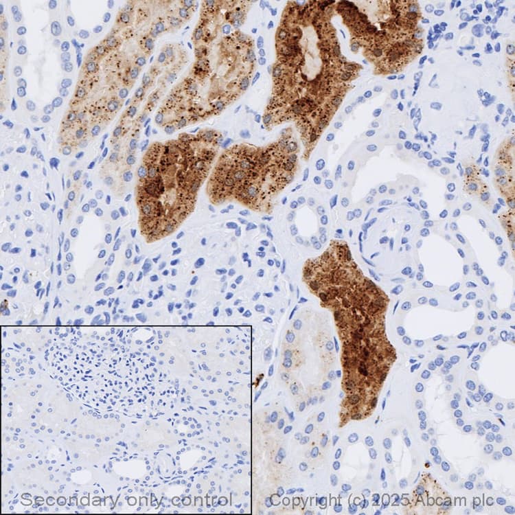 Anti-Lysozyme antibody [EPR2994(2)](AB108508)