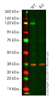 Anti-N Cadherin antibody [EPR1791-4](AB76011)