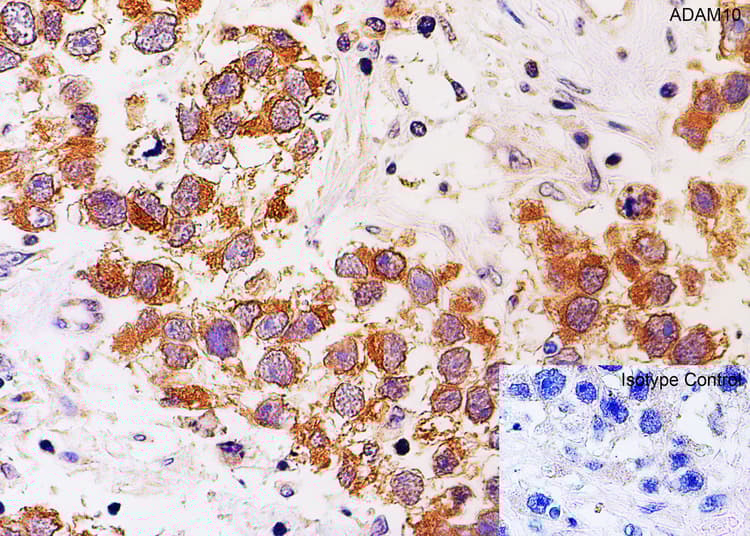 Anti-ADAM10 antibody(AB1997)