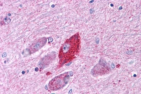 Anti-CRF1/CRHR1 antibody - N-terminal(AB230803)