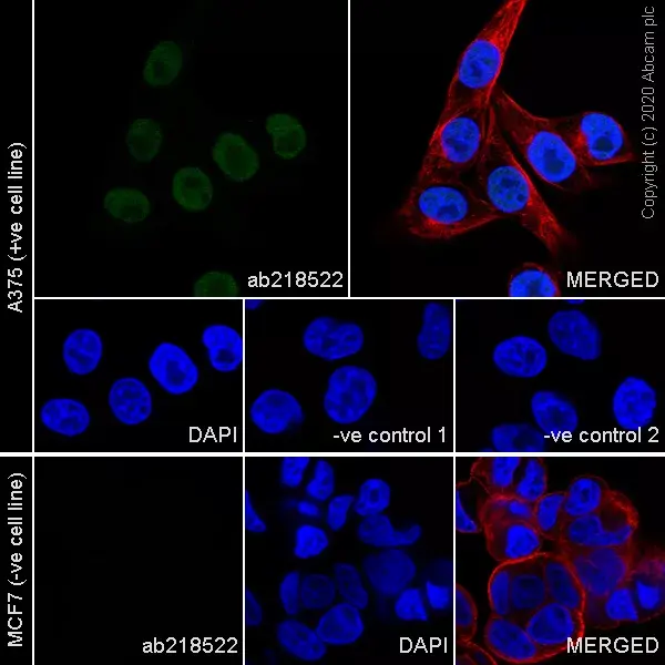 Goat Anti-Rabbit IgG H&L (Alexa Fluor® 594)(AB150080)