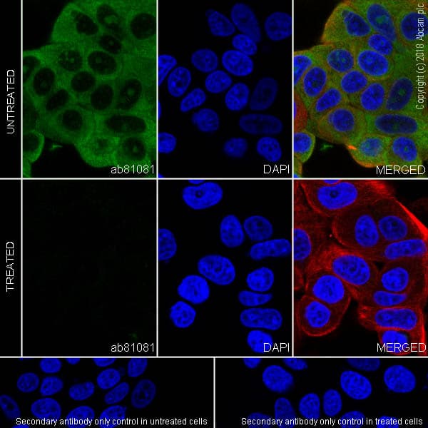 Rps6 Phospho S240 S244 Antibody Sp45 Ab81081  Immunocytochemistry Immunofluorescence Img127339