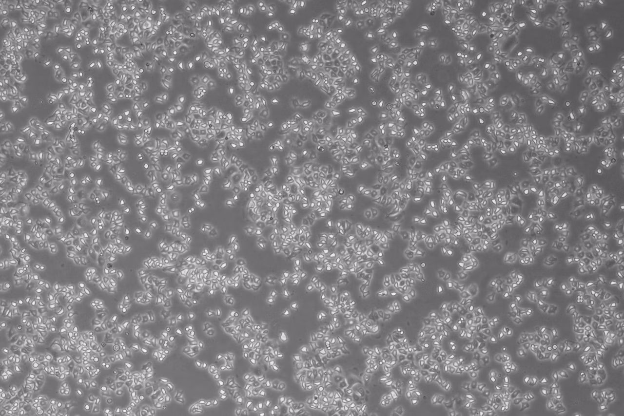 Hela4 Cells Left Kid21764932