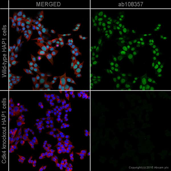 Anti-Cdk4 antibody [EPR4513-32-7](AB108357)