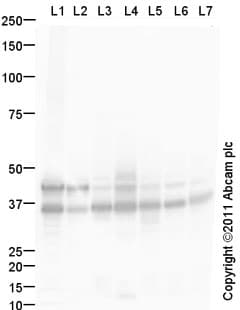 Anti-EpCAM antibody(AB71916)