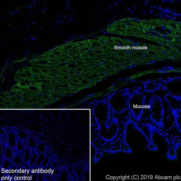 Anti-Fibronectin antibody [EPR23110-46](AB268020)
