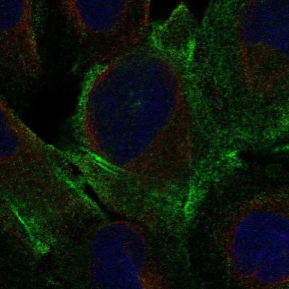 Anti-DDR2 antibody(AB221812)