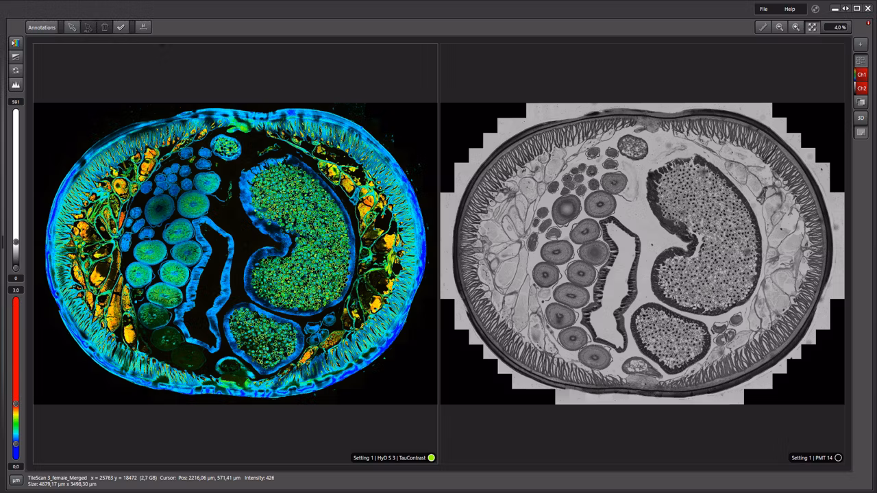 Identification Of Distinct Structures Roundworm LAS X Navigator Kid21765102