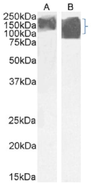Anti-Alpha Gal antibody [m86] - Human IgM (Chimeric)(AB281899)