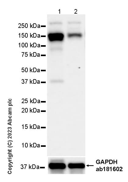 Mda5 Antibody Epr28350 21 Ab315242  Western Blot Img424421