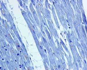 Snap25 Antibody Ep3274 Ab108990  Immunohistochemistry Formalin Pfa Fixed Paraffin Embedded Sections Img114605