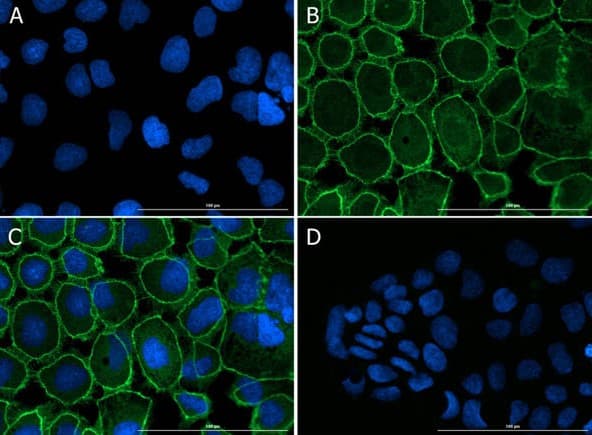 Anti-ZO1 tight junction protein antibody(AB216880)