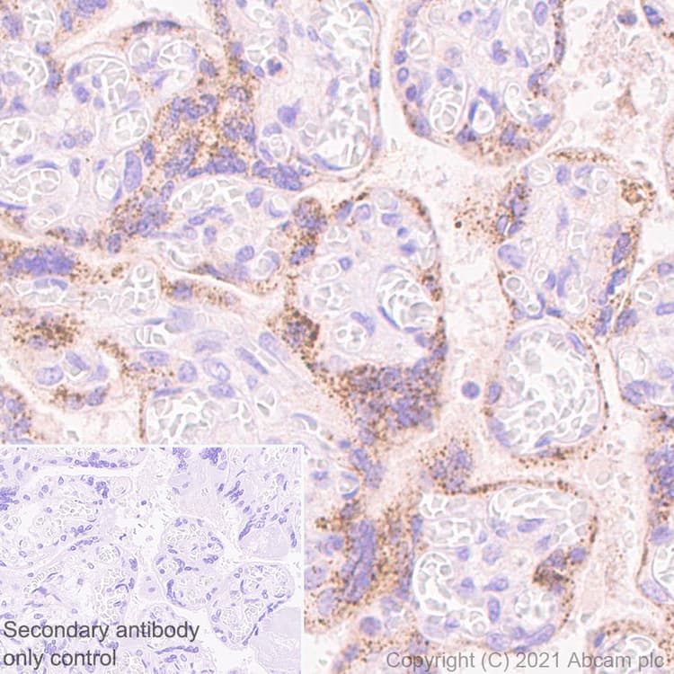 Socs3 Antibody Epr24090 74 Ab280884  Immunohistochemistry Formalin Pfa Fixed Paraffin Embedded Sections Img118396