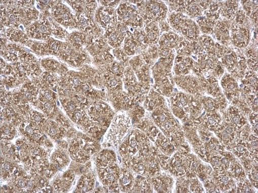 Etfa Antibody Ab153722  Immunohistochemistry Formalin Pfa Fixed Paraffin Embedded Sections Img132612