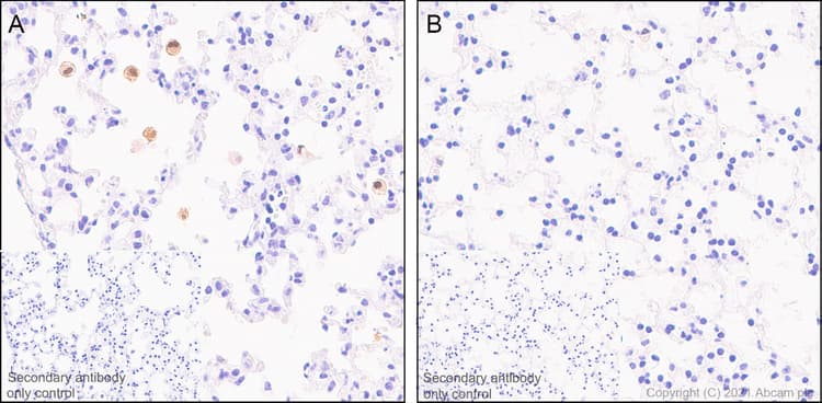 Anti-IL-1 beta antibody [RM1009](AB283818)